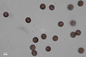 Attēlu rezultāti vaicājumam “Physarum bryomacrocarpum macro”