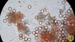 Attēlu rezultāti vaicājumam “Didymium megalosporum macro”