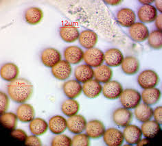 Attēlu rezultāti vaicājumam “Licea chelonoides spores”