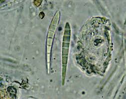 Attēlu rezultāti vaicājumam “Scoliciosporum chlorococcum”