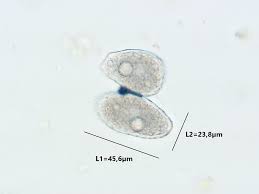 Attēlu rezultāti vaicājumam “Milesina murariae”