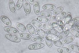 Attēlu rezultāti vaicājumam “Ombrophila violacea”