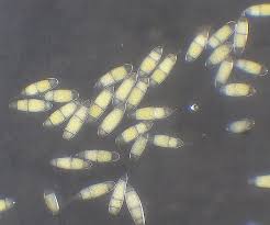 Attēlu rezultāti vaicājumam “Bactridium flavum”