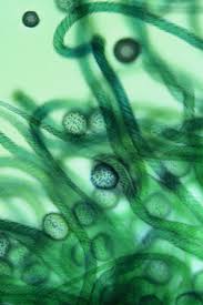 Attēlu rezultāti vaicājumam “Trichia crateriformis macro”