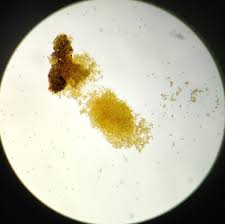 Attēlu rezultāti vaicājumam “Seligeria donniana”