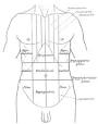 Abdominal pain - Wikipedia, the free encyclopedia