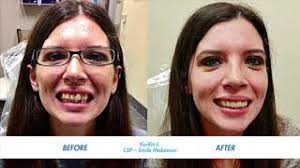 Image result for Smiles For Everyone