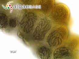 Attēlu rezultāti vaicājumam “Nostoc commune macro”