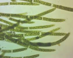 Attēlu rezultāti vaicājumam “Cladophora glomerata”