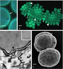 Attēlu rezultāti vaicājumam “Fossombronia wondraczekii spores”