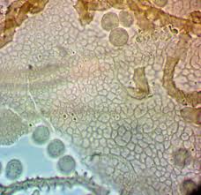 Attēlu rezultāti vaicājumam “Heterotrichia oerstedii (syn. Arcyria oerstedii) macro”