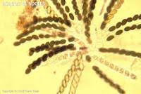 Attēlu rezultāti vaicājumam “Sordaria fimicola”