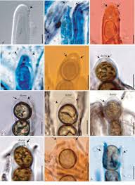 Attēlu rezultāti vaicājumam “Ombrophila violacea spores”