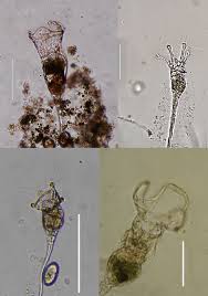Attēlu rezultāti vaicājumam “Tubifera applanata sessile”