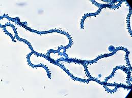 Attēlu rezultāti vaicājumam “Arcyria affinis capillitium”
