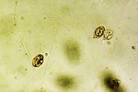 Attēlu rezultāti vaicājumam “Didymium xanthopus macro”