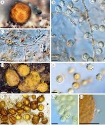 Attēlu rezultāti vaicājumam “Perichaena sp.”