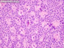 Attēlu rezultāti vaicājumam “Leiocolea rutheana cells”