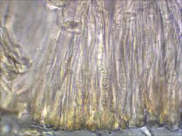 Attēlu rezultāti vaicājumam “Biatora sphaeroides”