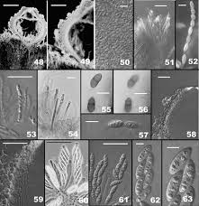 Attēlu rezultāti vaicājumam “Neonectria fuckeliana”