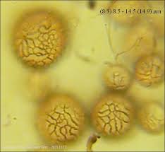 Attēlu rezultāti vaicājumam “Symphytocarpus trechisporus macro”