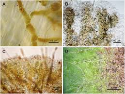 Attēlu rezultāti vaicājumam “Trentepohlia sp.”