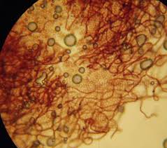 Attēlu rezultāti vaicājumam “Arcyria denudata macro”