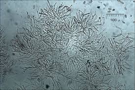 Attēlu rezultāti vaicājumam “Dacrymyces chrysospermus spores”