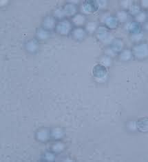 Attēlu rezultāti vaicājumam “Arcyria incarnata calyculus”