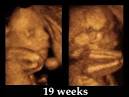 Fetal Development Week 5 Pregnancy Health Guru