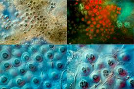 Attēlu rezultāti vaicājumam “Gloeocapsa rupestris”