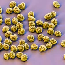 Attēlu rezultāti vaicājumam “Lycogala botrydium spores”