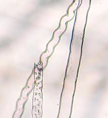 Attēlu rezultāti vaicājumam “Conocephalum salebrosum sporophyte”