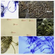 Attēlu rezultāti vaicājumam “Perichaena corticalis sessile”