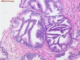 Attēlu rezultāti vaicājumam “Cribraria piriformis young”