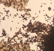 Attēlu rezultāti vaicājumam “Badhamia lilacina var. megaspora spores”