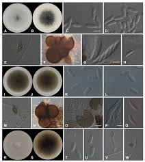 Attēlu rezultāti vaicājumam “Craterium aureonucleatum spores”