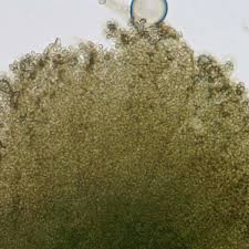 Attēlu rezultāti vaicājumam “Microcalicium disseminatum”