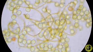 Attēlu rezultāti vaicājumam “Perichaena depressa”