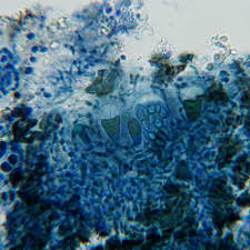 Attēlu rezultāti vaicājumam “Arthonia byssacea”