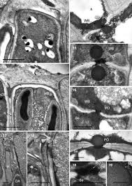 Attēlu rezultāti vaicājumam “Orbilia sp.”