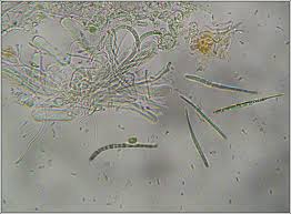 Attēlu rezultāti vaicājumam “Bacidia rubella”