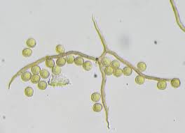 Attēlu rezultāti vaicājumam “Trichia contorta”