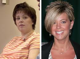 Kate Gosselin before and after photos (image hosted by http://bumpshack.com)