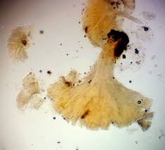 Attēlu rezultāti vaicājumam “Hymenoscyphus fructigenus var. coryli”