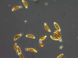 Attēlu rezultāti vaicājumam “Didymium clavus stalked”