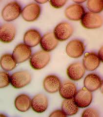 Attēlu rezultāti vaicājumam “Badhamia flavoglauca”