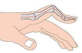 Znalezione obrazy dla zapytania palec