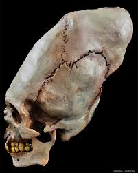 Image result for elongated skulls
