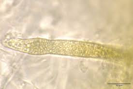 Attēlu rezultāti vaicājumam “Physarum viride var. aurantium spores”